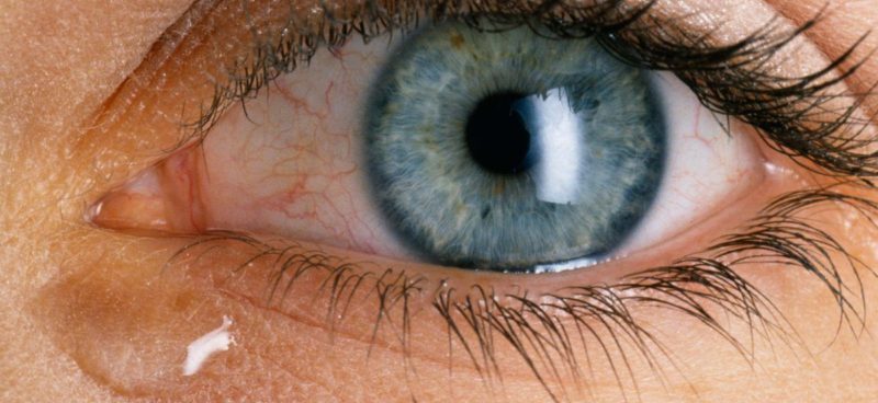 Eye Injury Symptoms