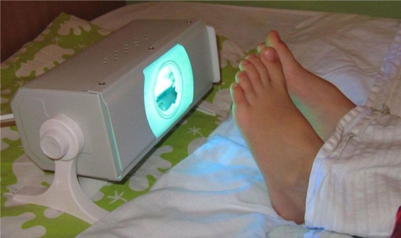 Foot irradiation for cold and sore