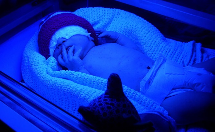 Description and principle of the lamp for jaundice