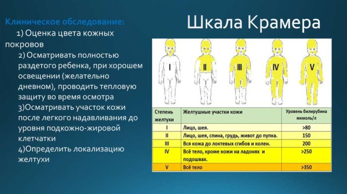 Description and operation principle of the lamp for jaundice